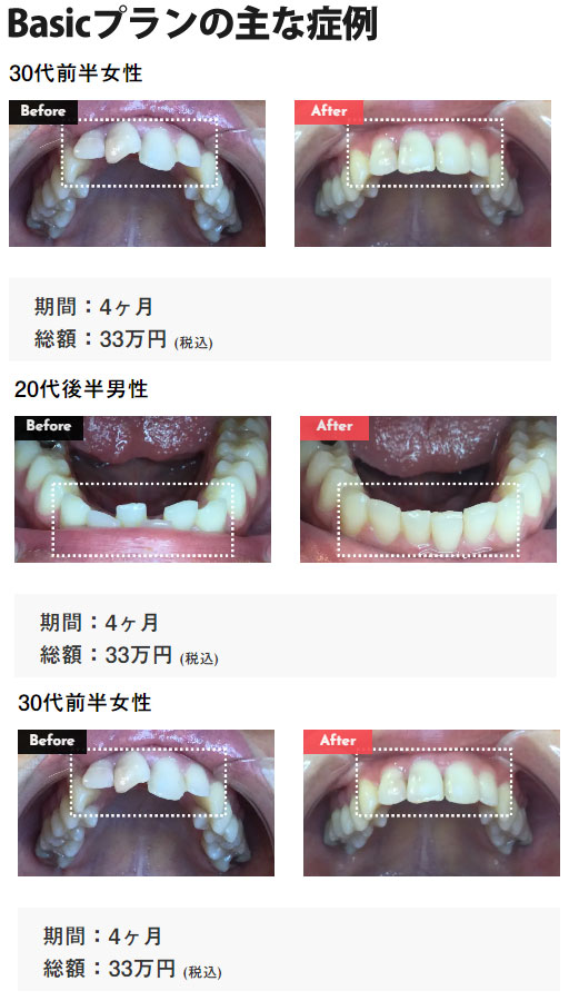 Basicプランの主な症例