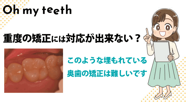 Oh my teethは重度の矯正には対応が出来ない