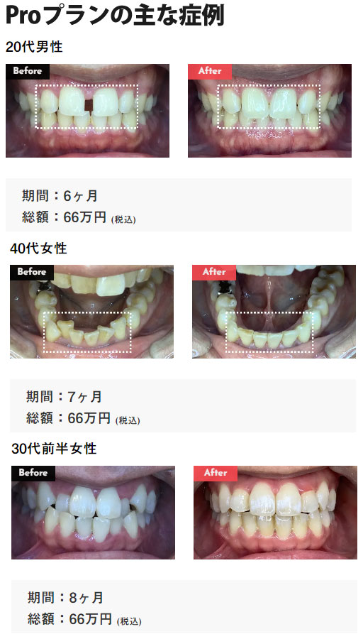 Proプラン一律66万円コース