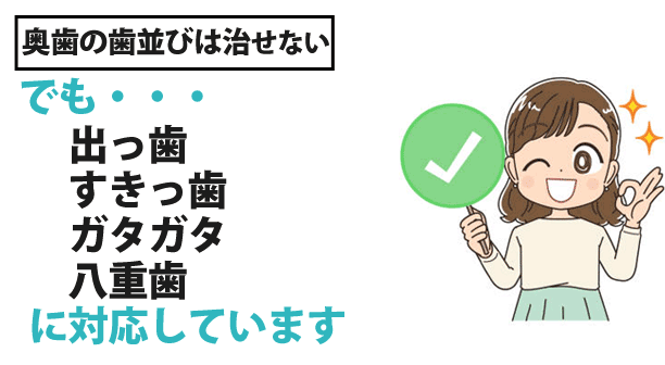 出っ歯やすきっ歯、ガタガタした歯列、八重歯などの歯並びに対応