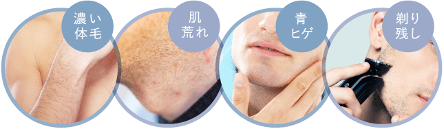 新宿 立川 横浜で男性メンズの胸 ヒゲ 全身医療脱毛なら 新宿美容外科クリニック 公式